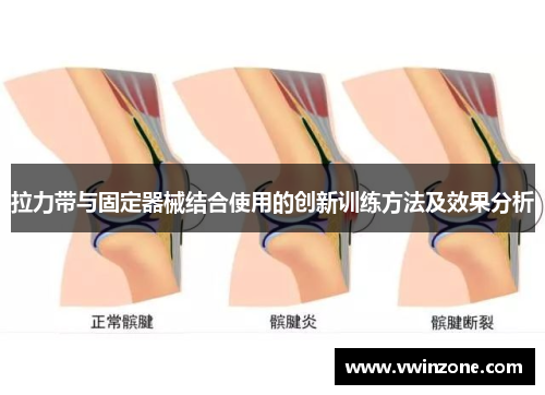 拉力带与固定器械结合使用的创新训练方法及效果分析
